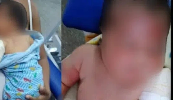 Bebê tem braço fraturado durante parto no interior do AM e família pede ajuda