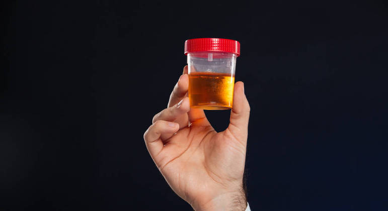 Exame de urina identifica doença de Alzheimer em estágio inicial